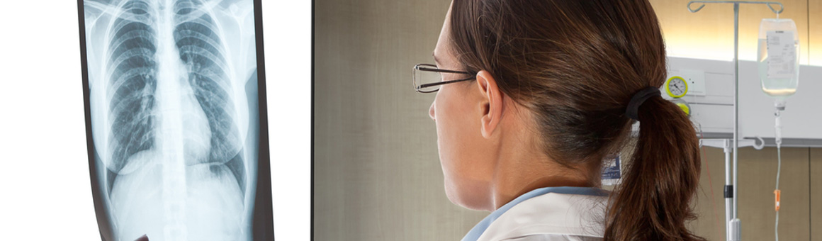 Asbestos related disease - How to spot the warning signs